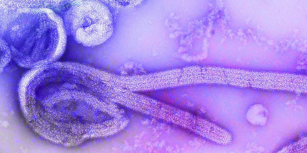 Image of microscopic view of Ebola virus