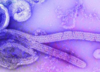 Ebola Virus: History, Types, Symptoms, Prevention, Treatment, And Myths 12 Image of microscopic view of Ebola virus