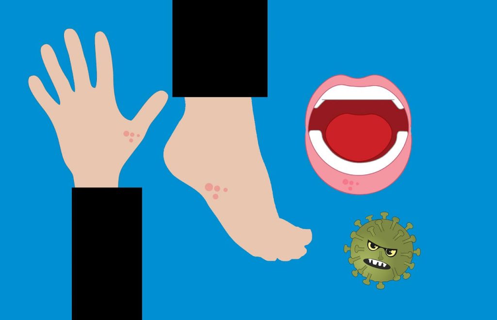 Image of Skin and Mouth Rash due to Coronavirus