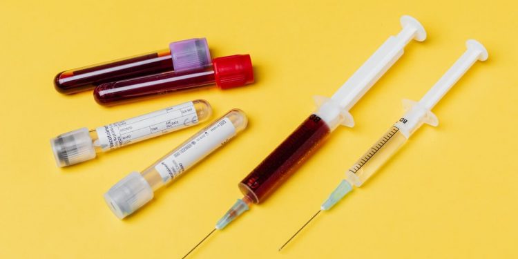 Syringes and blood test tube samples on a yellow background