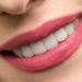woman with healthy beautiful teeth smiling